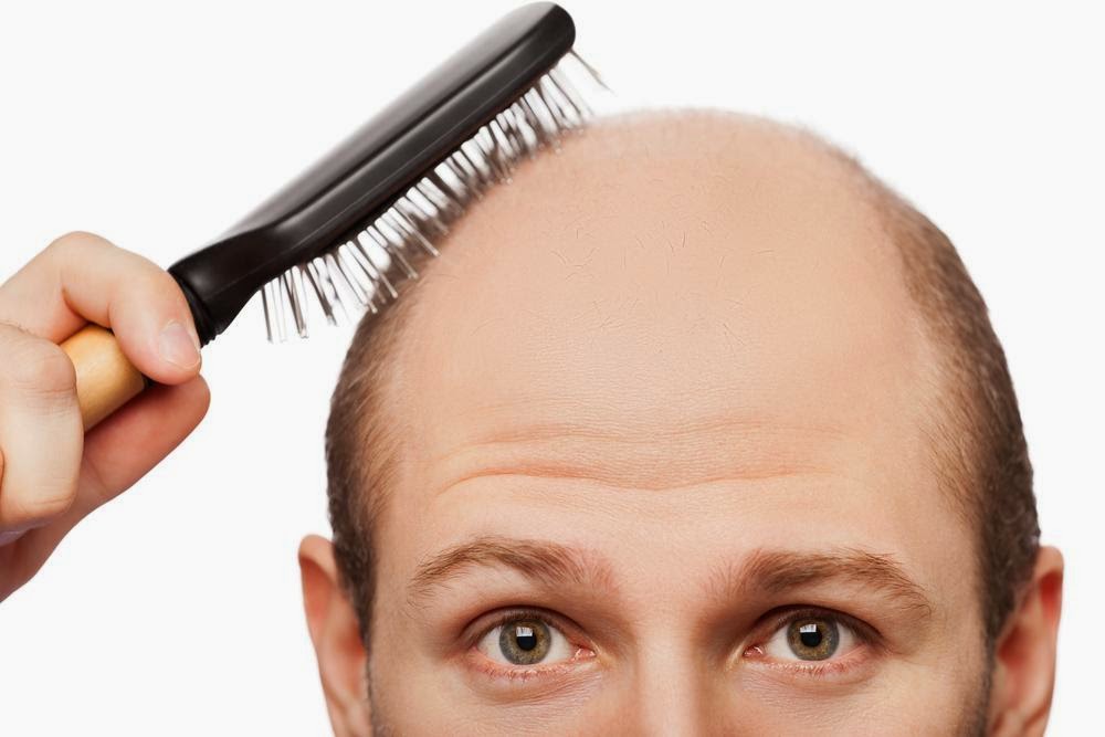 Photo of للرجال: كيف تحافظ على ما تبقى من شعرك ؟